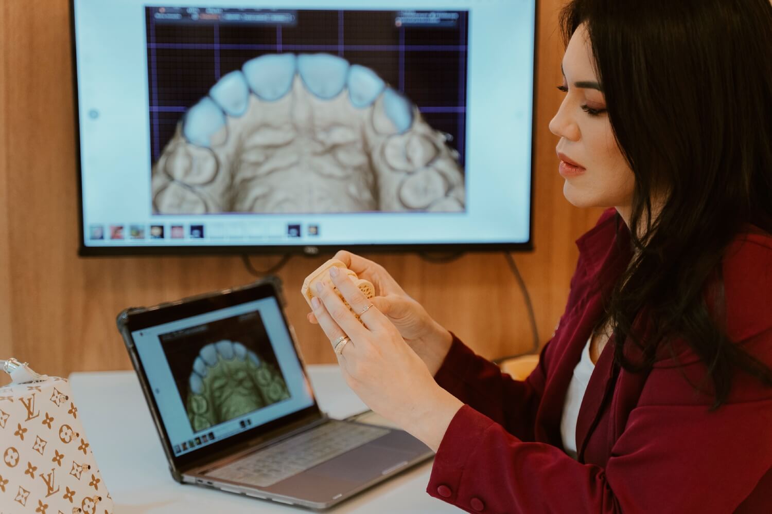 Implante Dentário Rio das Ostras